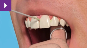 Fresh Breath